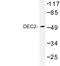 Class E basic helix-loop-helix protein 41 antibody, LS-B9787, Lifespan Biosciences, Western Blot image 