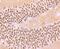 BAF Chromatin Remodeling Complex Subunit BCL11B antibody, NBP2-67181, Novus Biologicals, Immunohistochemistry paraffin image 