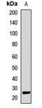 AlkB Homolog 7 antibody, LS-C668499, Lifespan Biosciences, Western Blot image 