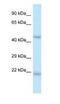 One Cut Homeobox 1 antibody, NBP1-91607, Novus Biologicals, Western Blot image 