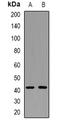 Actin Alpha 2, Smooth Muscle antibody, orb382726, Biorbyt, Western Blot image 