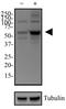 Sequestosome 1 antibody, NBP1-48320, Novus Biologicals, Western Blot image 