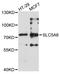 Solute Carrier Family 5 Member 6 antibody, STJ28517, St John