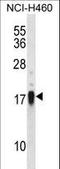 CD70 Molecule antibody, LS-C168561, Lifespan Biosciences, Western Blot image 