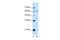 Interleukin-28 receptor subunit alpha antibody, GTX46260, GeneTex, Western Blot image 