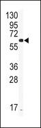 Cytochrome P450 Family 2 Subfamily J Member 2 antibody, 62-919, ProSci, Western Blot image 