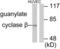 Guanylate cyclase soluble subunit beta-1 antibody, LS-B7603, Lifespan Biosciences, Western Blot image 