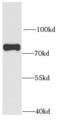 Sorting nexin-1 antibody, FNab08082, FineTest, Western Blot image 