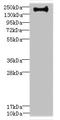 Erbb2 Interacting Protein antibody, LS-C675721, Lifespan Biosciences, Western Blot image 