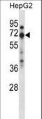 Zinc Finger Protein 395 antibody, LS-C160866, Lifespan Biosciences, Western Blot image 