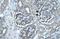 Pancreatic Lipase antibody, A04935, Boster Biological Technology, Immunohistochemistry paraffin image 