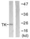 Thymidine Kinase 1 antibody, LS-C117719, Lifespan Biosciences, Western Blot image 