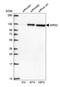 Isoleucyl-tRNA synthetase, mitochondrial antibody, HPA024594, Atlas Antibodies, Western Blot image 