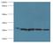 Hydroxysteroid 17-Beta Dehydrogenase 10 antibody, A56106-100, Epigentek, Western Blot image 