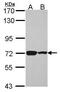 Phosphoenolpyruvate Carboxykinase 2, Mitochondrial antibody, PA5-30221, Invitrogen Antibodies, Western Blot image 