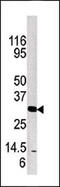 Kallikrein Related Peptidase 3 antibody, 62-245, ProSci, Western Blot image 