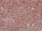 Spindlin 1 antibody, A07281-1, Boster Biological Technology, Immunohistochemistry paraffin image 