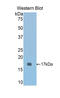 Cartilage Oligomeric Matrix Protein antibody, LS-C298649, Lifespan Biosciences, Western Blot image 