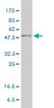 Peroxisome Proliferator Activated Receptor Delta antibody, H00005467-M01, Novus Biologicals, Western Blot image 