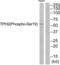 Tryptophan Hydroxylase 2 antibody, abx012729, Abbexa, Western Blot image 