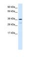 Vacuolar Protein Sorting 72 Homolog antibody, orb324509, Biorbyt, Western Blot image 