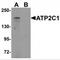 ATPase Secretory Pathway Ca2+ Transporting 1 antibody, MBS151043, MyBioSource, Western Blot image 