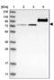 RAP1 GTPase Activating Protein 2 antibody, NBP1-93721, Novus Biologicals, Western Blot image 