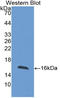 Fatty Acid Binding Protein 4 antibody, LS-C314820, Lifespan Biosciences, Western Blot image 