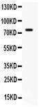 Interleukin 7 antibody, PB9521, Boster Biological Technology, Western Blot image 