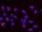 BRCA1 DNA Repair Associated antibody, NB100-224, Novus Biologicals, Proximity Ligation Assay image 