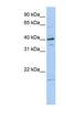 Tubulin Polymerization Promoting Protein Family Member 3 antibody, NBP1-57640, Novus Biologicals, Western Blot image 