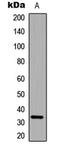 Calponin 2 antibody, LS-C354628, Lifespan Biosciences, Western Blot image 