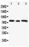 GLI Family Zinc Finger 3 antibody, PA1766, Boster Biological Technology, Western Blot image 