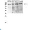 Dishevelled Associated Activator Of Morphogenesis 1 antibody, LS-C813836, Lifespan Biosciences, Western Blot image 