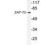 Zeta Chain Of T Cell Receptor Associated Protein Kinase 70 antibody, LS-C177646, Lifespan Biosciences, Western Blot image 