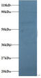 Protein Phosphatase 2 Catalytic Subunit Beta antibody, MBS715027, MyBioSource, Western Blot image 