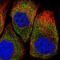 Epithelial Stromal Interaction 1 antibody, PA5-53595, Invitrogen Antibodies, Immunofluorescence image 