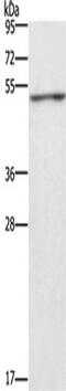 Creatine Kinase, Mitochondrial 2 antibody, TA349810, Origene, Western Blot image 