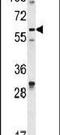 Decapping MRNA 1B antibody, PA5-26885, Invitrogen Antibodies, Western Blot image 