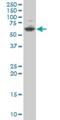 Zinc Finger Protein 35 antibody, H00007584-B01P, Novus Biologicals, Western Blot image 