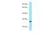 Lysozyme G2 antibody, A14366, Boster Biological Technology, Western Blot image 