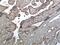 Insulin Like Growth Factor Binding Protein 5 antibody, NBP2-12366, Novus Biologicals, Immunohistochemistry paraffin image 