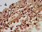 Spindle And Kinetochore Associated Complex Subunit 3 antibody, LS-C674568, Lifespan Biosciences, Immunohistochemistry paraffin image 