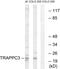 Trafficking Protein Particle Complex 3 antibody, GTX87644, GeneTex, Western Blot image 