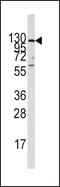 Insulin-degrading enzyme antibody, PA5-11520, Invitrogen Antibodies, Western Blot image 