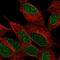Inositol Polyphosphate-4-Phosphatase Type I A antibody, HPA001628, Atlas Antibodies, Immunofluorescence image 