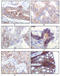 Insulin Like Growth Factor 1 Receptor antibody, M00070, Boster Biological Technology, Immunohistochemistry paraffin image 