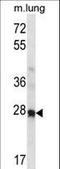 Homeobox A4 antibody, LS-C164404, Lifespan Biosciences, Western Blot image 