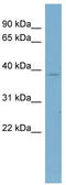 Calcium-binding protein 39 antibody, TA345040, Origene, Western Blot image 