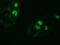 Zinc Finger Imprinted 2 antibody, M15131, Boster Biological Technology, Immunofluorescence image 